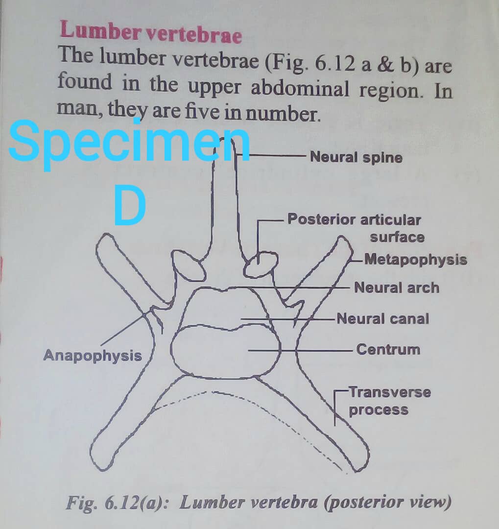 SPECIMEN D - Lumbar vertebra